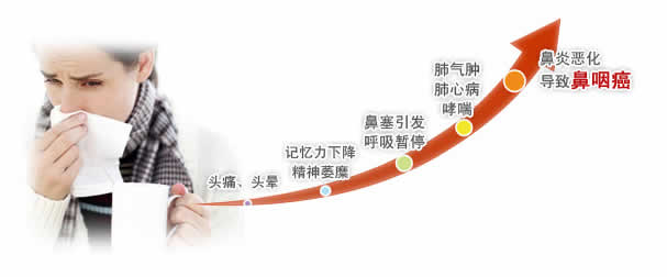过敏性鼻炎