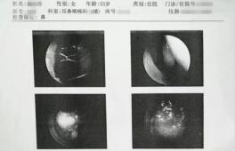 一年内3次手术！肿瘤君，想要逃离你为何这么难？